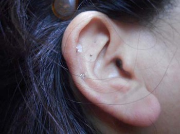 初体験! 『耳つぼピアス』 ^^