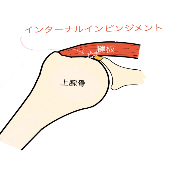 レイトコッキング期の肩痛セルフチェックVo1 レイトコッキング期の肩痛セルフチェックVo1