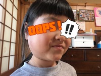 おたふくその後