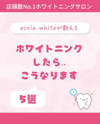 ホワイトニングをしたら…✨