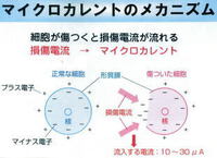 マイクロカレント療法 2025/03/19 11:19:00