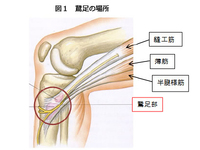 マラソンランナーの皆様へ蹴りだしで痛かっ･･･