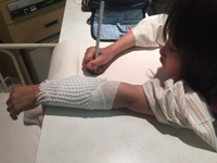痛々しい(｡-_-｡) 2015/01/28 15:30:59