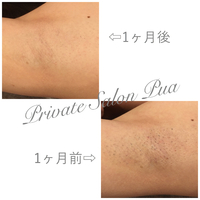抜け落ち抜群❤️before ＆ after 2019/06/06 16:38:24