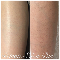 ひざ下脱毛❤️before ＆ after 2019/06/08 16:23:26