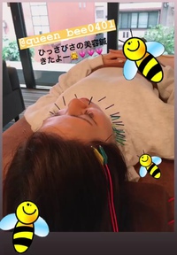むくみスッキリ美容鍼✨ 2019/06/11 13:04:14