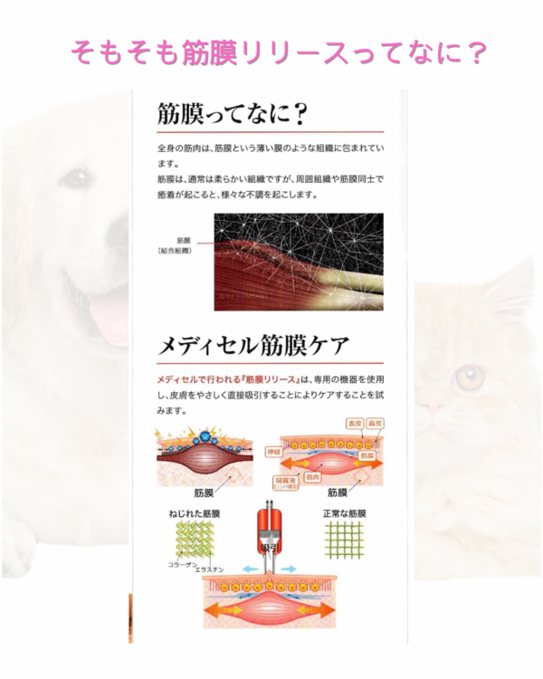 筋膜リリースって何ですか？