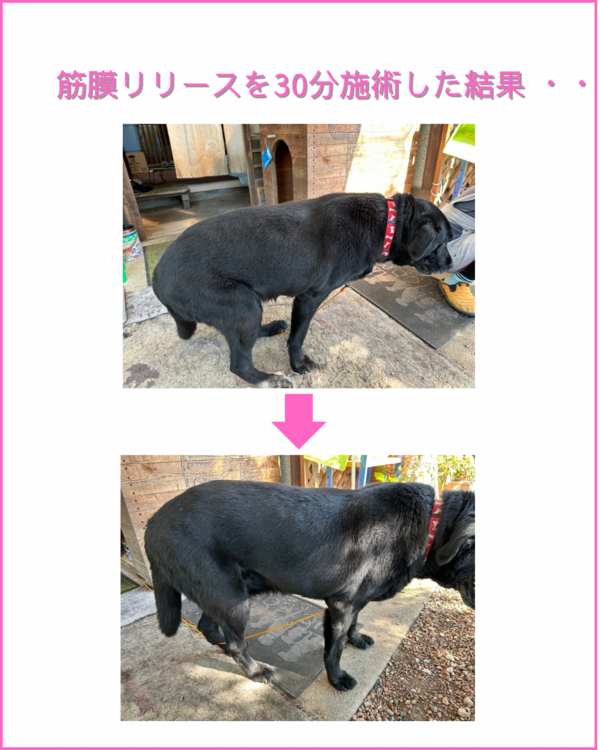 筋膜リリースの結果・・