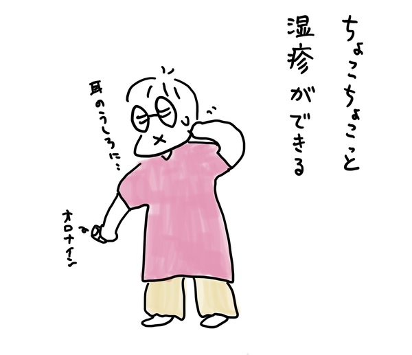 湿疹