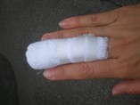 ひょうそ・・・(指腹部化膿炎)★